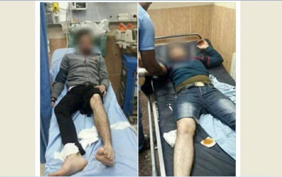 70 اصابة واعتقال 7 باقتحام الاحتلال لمدينة نابلس