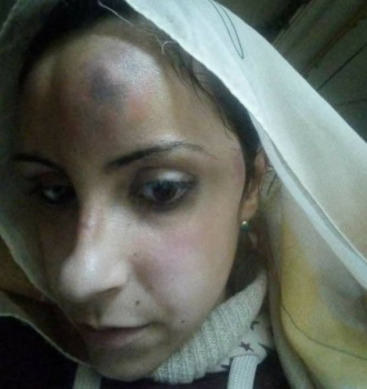 أسرة مصرية تبرح طليقة ابنهم ضرباً.. والسبب لا يصدّق