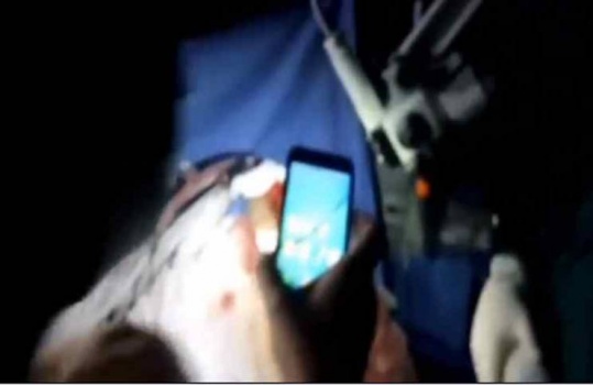 فيديو| عملية جراحية في 'المخ' على أضواء الهواتف المحمولة تثير جدلاً واسعاً!
