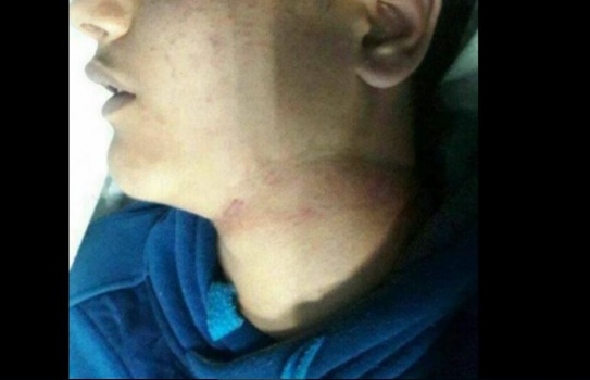 وصول فتى جثة "هامدة" لمشفى الشفاء بغزة وعليه آثار خنق