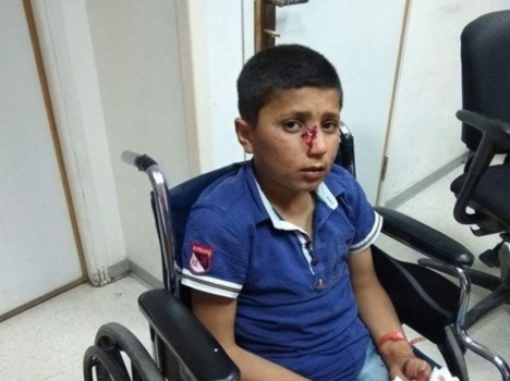 مستوطنون يهاجمون طلاب مدرسة ذكور الكرمل بالحجارة