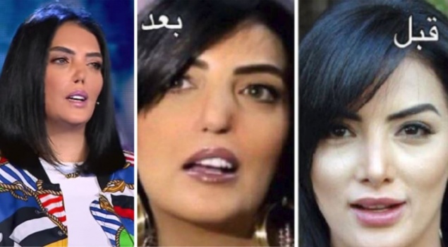 بالفيديو.. حورية فرغلي تكشف سبب تشوهها!