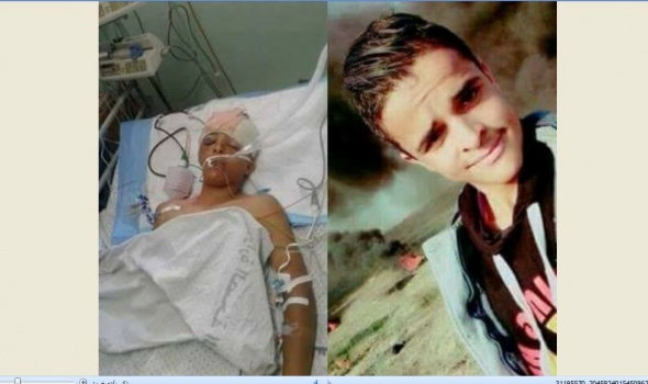 استشهاد طفل أصم متأثرًا بجراحه بغزة