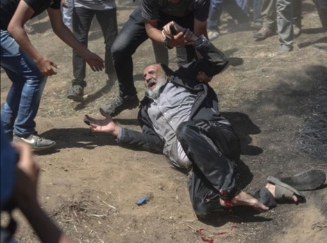 "الأونروا": عدد كبير من جرحى غزة سيعانون من إعاقات طويلة الأمد