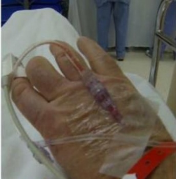 مأساة فنان عربي لا يجد نفقة علاجه من السرطان.. وهكذا علق زميله