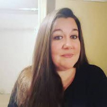 لا تدعي أولادك يلهون بشاحن الجوال... ما فعله بوجه هذه الطفلة مخيف (صورة)