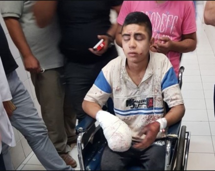 اصابة فتى بانفجار جسم مشبوه في الخليل
