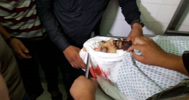 الشهيد عبد الكريم رضوان.. هل تحرم والدته نظرة الوداع مرة أخرى؟
