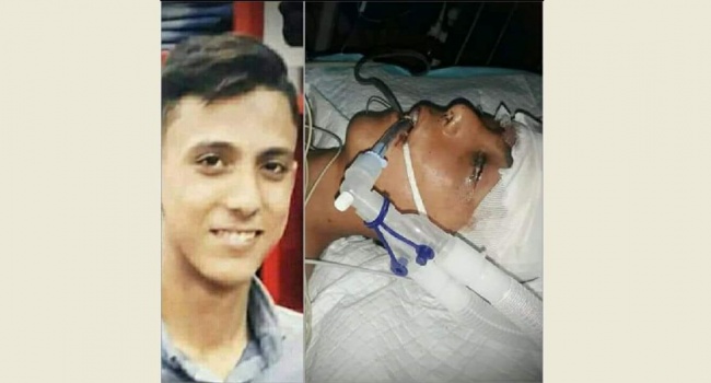 استشهاد طفل متأثرًا بإصابته في مليونية العودة شرق غزة