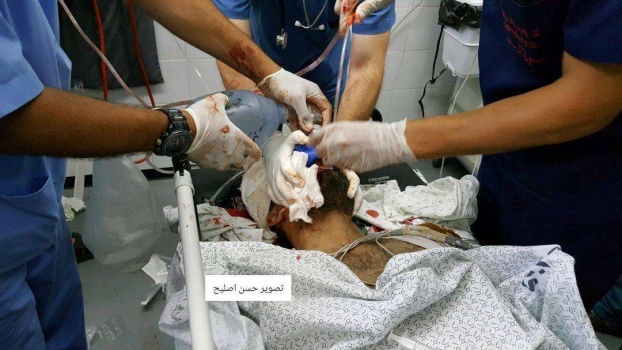 شهيد و3 إصابات في قصف إسرائيلي برفح