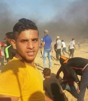 استشهاد شاب متأثرا باصابته بمسيرات العودة