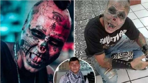 شاب يبتر أنفه ويقطع أذنيه لسبب خاص.. فما قصته؟