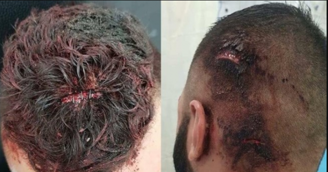 صور مؤلمة- فتكوا بهم لأنهم "عرب"