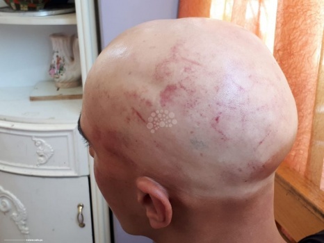 بالصور...محققو الاحتلال في المسكوبية يعتدون بهمجية على شاب مقدسي