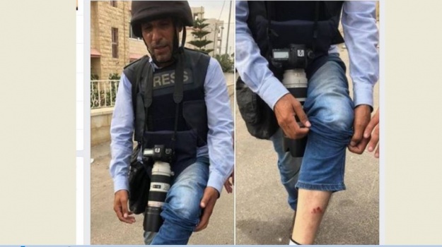 إصابة مصور صحفي من جنين برصاصة مطاطية خلال مواجهات مع الإحتلال في رام الله