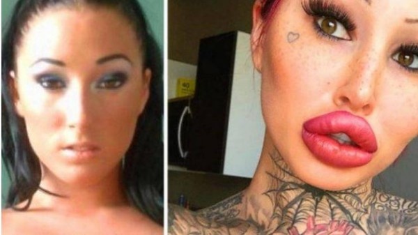 صور: خضعت لعمليات التجميل لـ 4 سنوات متواصلة... لن تصدقوا شكلها الآن