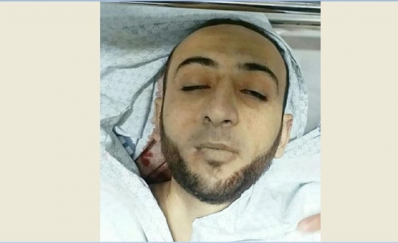 غزة: استشهاد شاب متأثرًا بجراحه شرق البريج