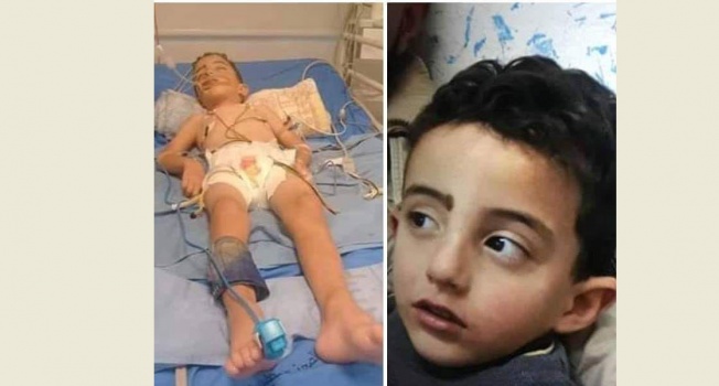 فيديو..إصابة طفل بجراح حرجة اثر سقوطه بحفرة صرف صحي في بيتونيا