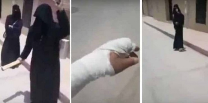 فتاة تكسر يد أبيها لسبب غريب .. تثير جدلا واسعا على مواقع التواصل الاجتماعي