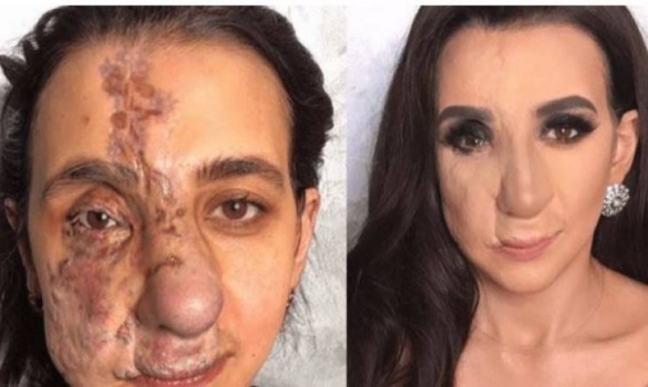لم يصادقها أحد بسبب تشوّه وجهها... وما فعلته معها خبيرة التجميل مؤثر جداً