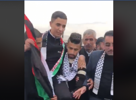 بالفيديو : جلال يعود إلى منزله دون قدمه!