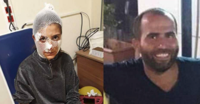 تركي فشل في إغواء امرأة.. فانتقم منها بوحشية