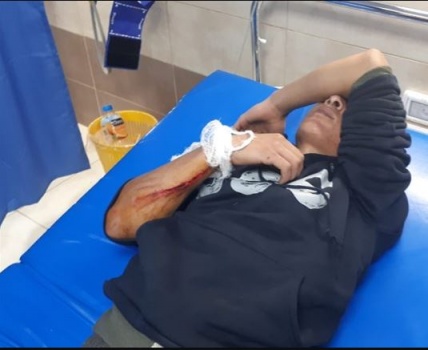 إصابة شاب اثر دهسه من قبل مستوطن شرق بيت لحم