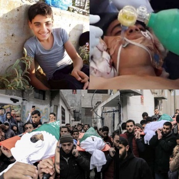 صور..استشهاد طفل متأثرا بجراحه في غزة