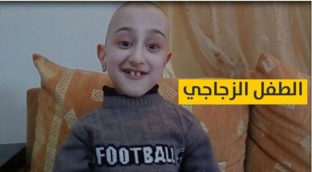 فيديو:تعرفوا على قصة الطفل الزجاجي طريح الفراش منذ 11 عاماً في نابلس
