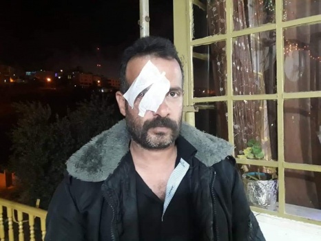 صور وفيديو..الاحتلال يعتدي على عائلة بالخليل