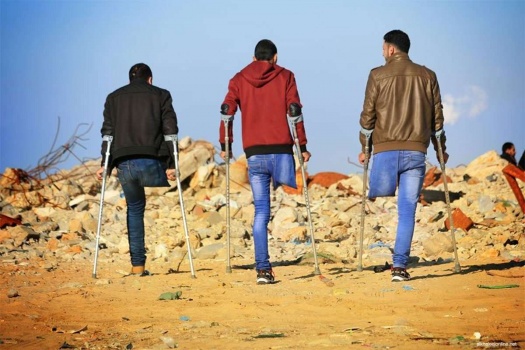 الأمم المتحدة: المئات معرضون لخطر بتر أطرافهم في غزة