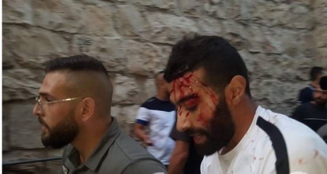 جنود يعتدون بالضرب الوحشي على عدد من المقدسيين