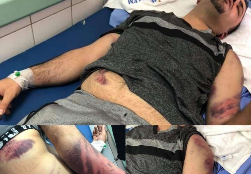 القبض على سبعة اشخاص في رام الله لاعتدائهم على محامي بالعيزريةوبحوزتهم كمبيالات بمليون دولار