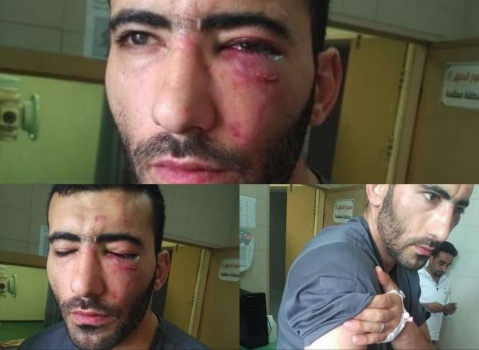 وزيرة الصحة: القانون سيلاحق المعتدين على الطواقم الطبية