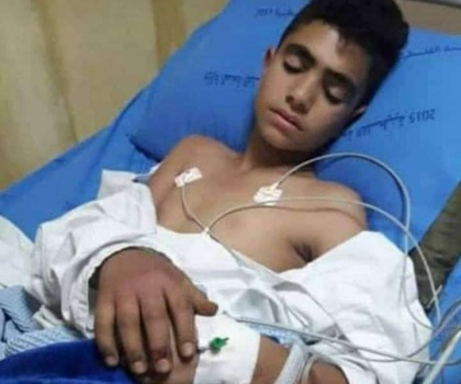 إصابة طفل من قرية العرقة غرب جنين بلدغة أفعى