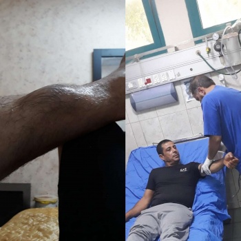 جنود الاحتلال يعتدون على مواطن من قرية سيريس جنوب جنين على حاجز عسكري