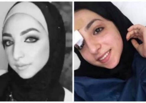 وزير العدل: غداً ستستلم النيابة نتائج تشريح 'إسراء'