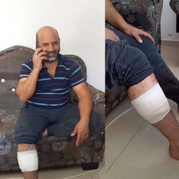 إصابة عامل من بلدة السيلة الحارثية برصاص قوات الاحتلال جنوبي جنين