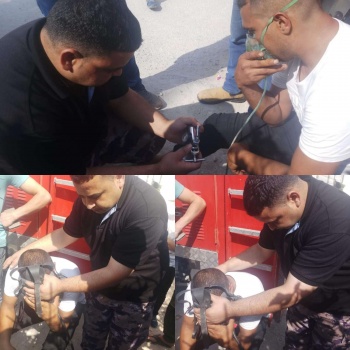 3إصابات بحريق أسطوانة غاز اثناء الطهي في احد الاعراس جنوب الخليل