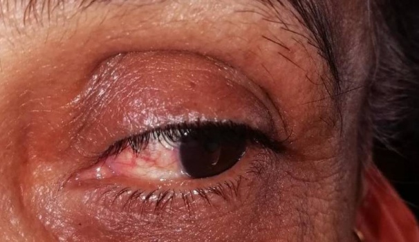مطالبات بتطبيق عقوبة "العين بالعين" بحادثة اعتداء زوج على زوجته