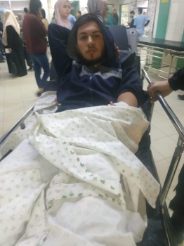 إصابة شاب برصاص الاحتلال في بيت أمر