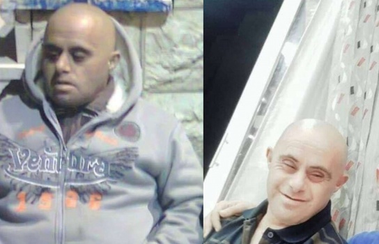 الخليل:مصرع شاب من ذوي الإحتياجات الخاصة بحادث دهس والسائق يلوذ بالفرار