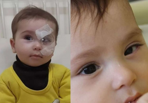 طبيب فلسطيني يعيد البصر لرضيع من غزة