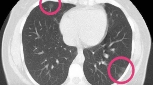 أسترالية أصرت على إجراء فحص كورونا بعد وفاة قريبها والنتيجة صادمة!