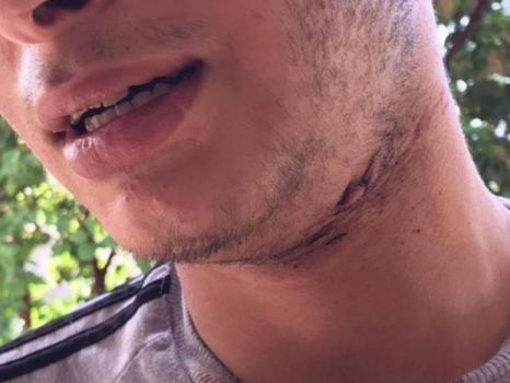 نجا بأعجوبة... محمد يروي قصة الإعتداء عليه من قِبل المستوطن أمس