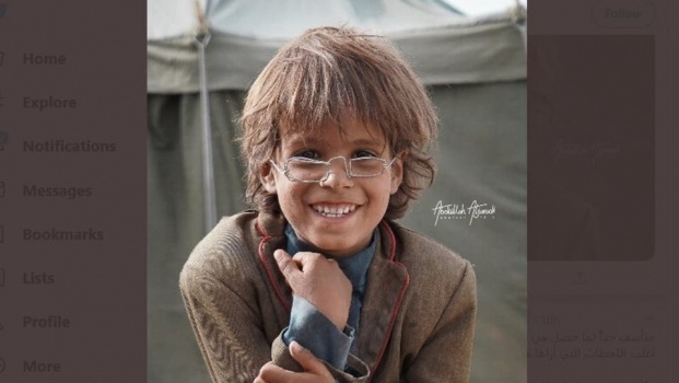 جديد النظارة الحديدية والطفل اليمني.. الصورة تفوز