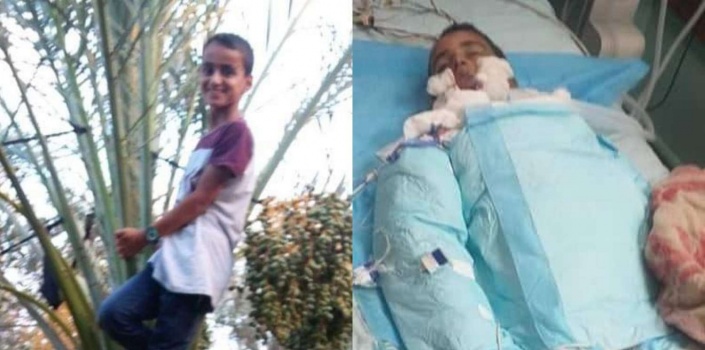 شاهد: تفاصيل مؤلمة لوفاة طفل حُرق حياً على يد مسلح مجهول في غزة