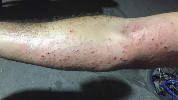 اصابة شاب من كفر قدوم بانفجار جسم مشبوه