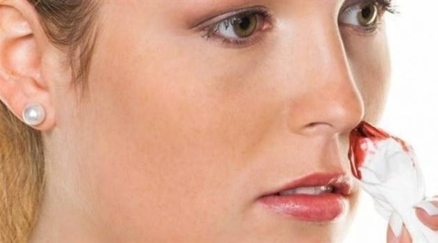 نزيف الأنف المتكرر ينذر بالإصابة بهذا المرض