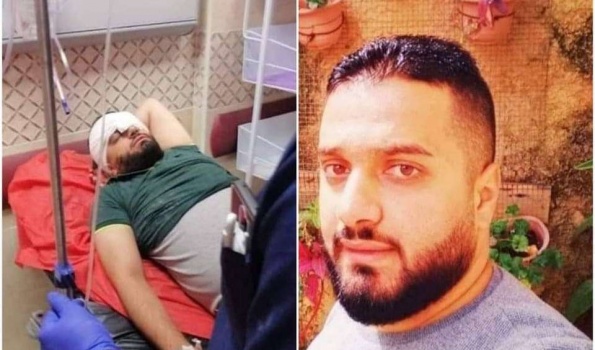 أسير محرر يفقد عينه برصاص الاحتلال أمس في سبسطية